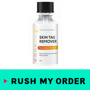 Essence Skin Tag Remover